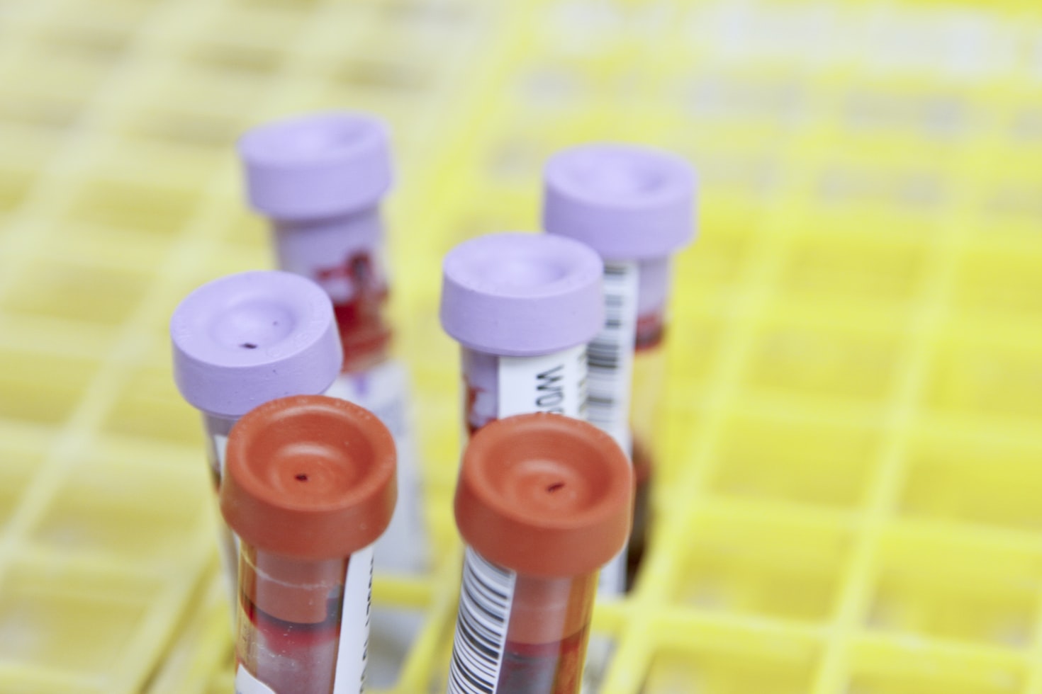 Medical testing process